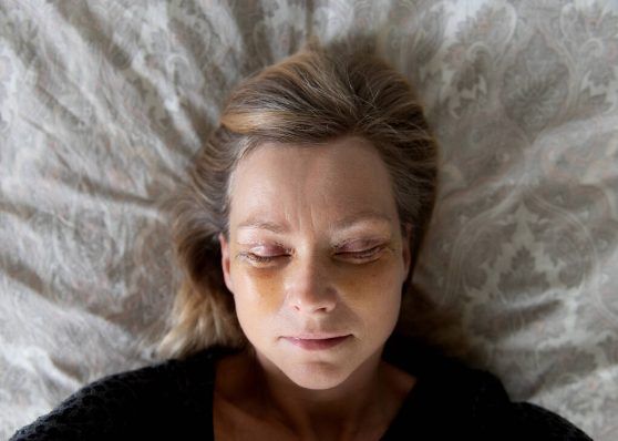 Affordable & Professional Double Eyelid Surgery in Singapore: Enhance Your Beauty Today