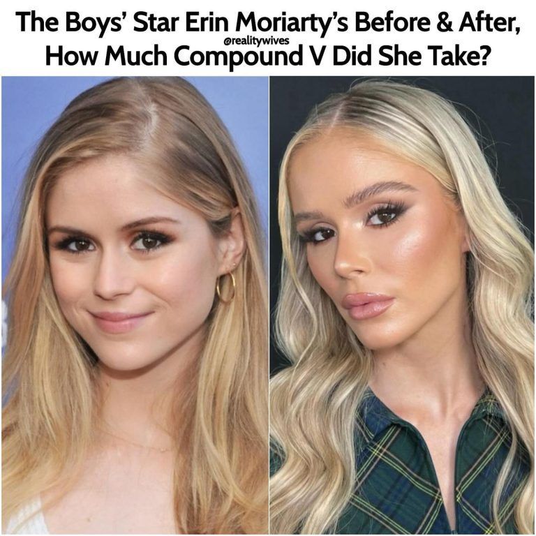 Starlight Before and After Shocking Transformation CEOColumn