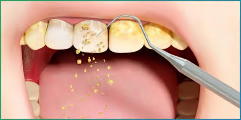 Dental Cleaning Cost: Find the Best Prices & Save Money