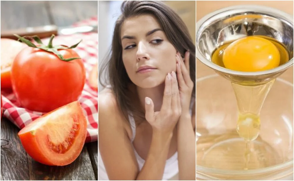 Poros Caseros: Remedios Naturales para una Piel Perfecta