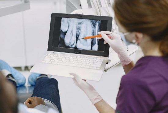 Benefits of Full Arch Dental Implants in Long Beach for Lasting Smiles