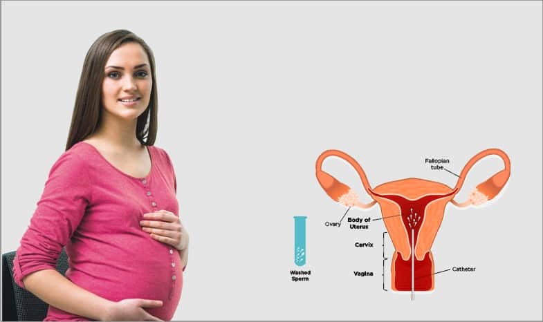 When do Fertility Specialists Recommend IUI Treatment in India?