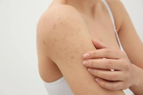 Vacation Next Week and Your Skin Suddenly Freaked Out?