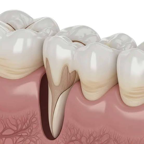 Why Tooth Sensitivity Shouldn’t Be Ignored