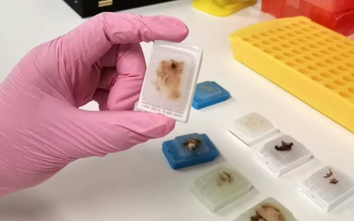 Essential Quality Checks Before Using an FFPE Block in Research
